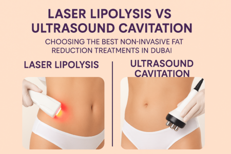 Fat Freezing Laser Lipolysis vs Ultrasound Cavitation Choosing the Best Non Invasive Fat Reduction Treatments in Dubai