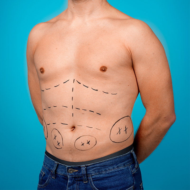VIVO Clinic MSculpt