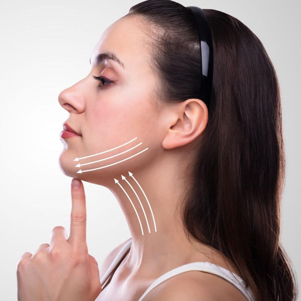chin fat redaction